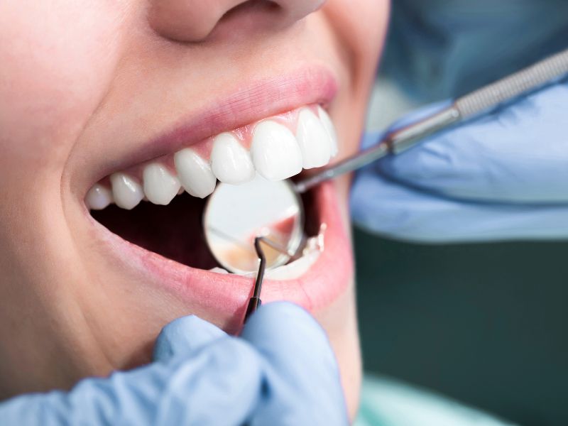 endodoncias odontologia