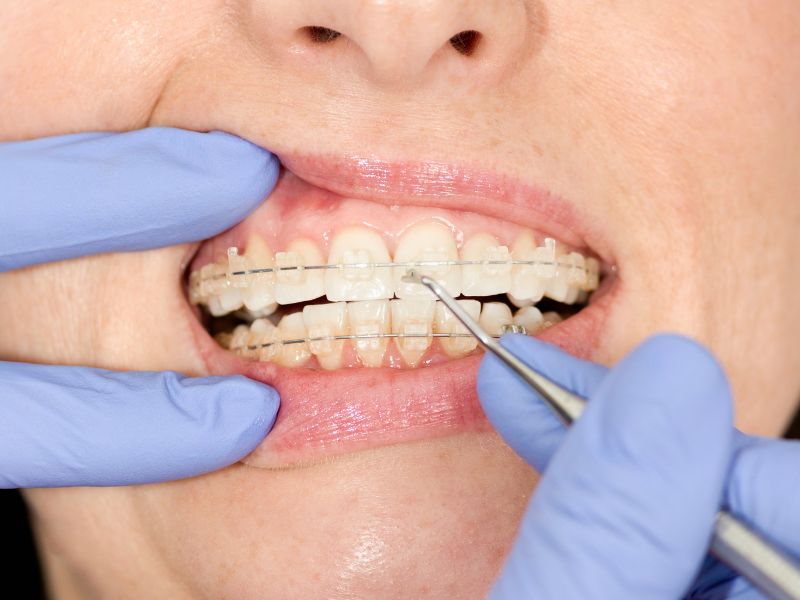 odontologia general para el cuidado de tu boca